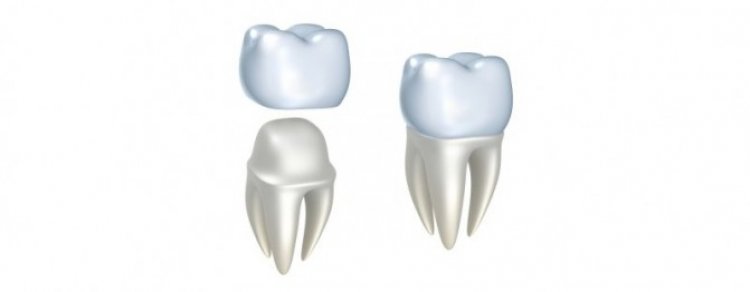 Cat de importanta este estetica dentara in viata oamenilor?
