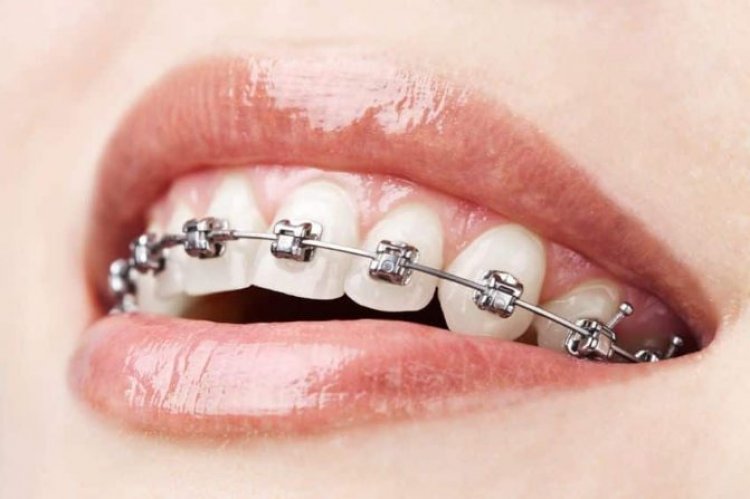 Ivory – cele mai moderne tehnici de diagnosticare a maplozitiei