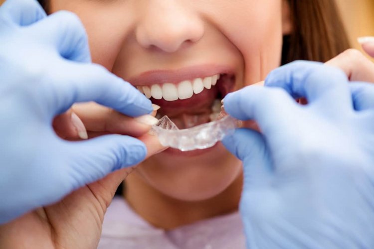 Impreuna cu noi,la Clinica stomatologica Ivory, gasiti rezolvarea oricaror probleme de sanatate