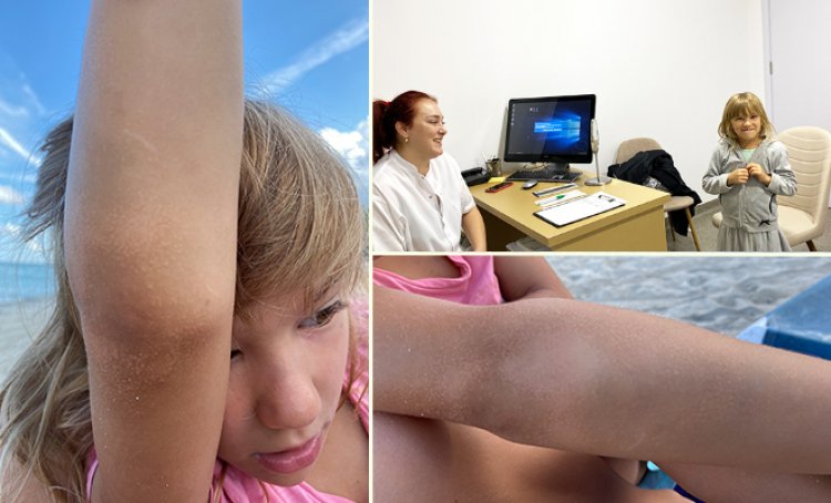 Dermatita Atopica? Hiperkeratoza Foliculara? Afla la ce sa te astepti in sezonul rece daca ai tenul atopic