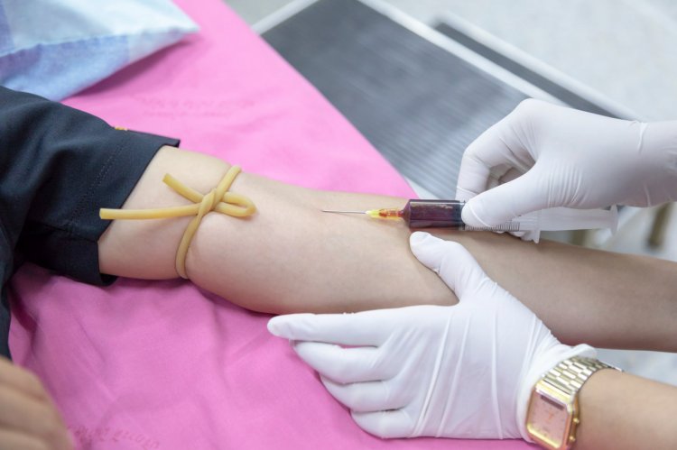 Ce analize medicale e recomandat să faci în fiecare an?
