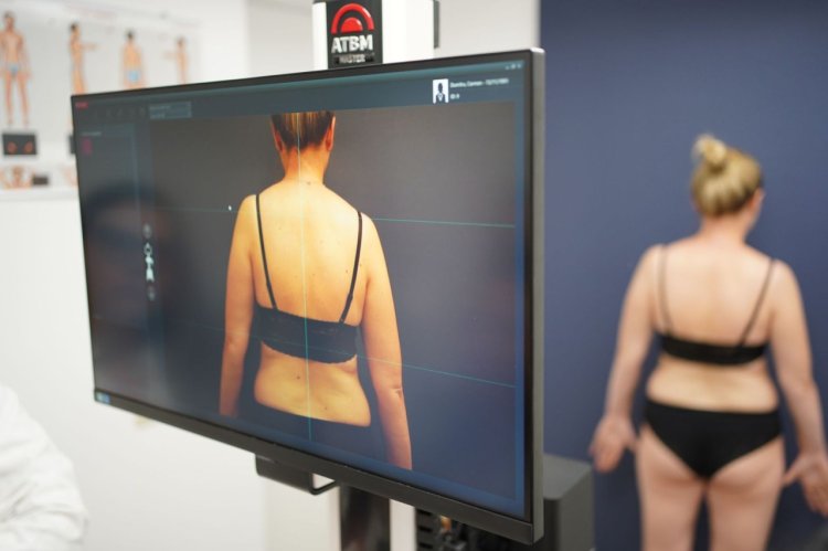 Wanderma introduce dermatoscopia digitală totală cu FotoFinder ATBM Master la clinica din Craiova