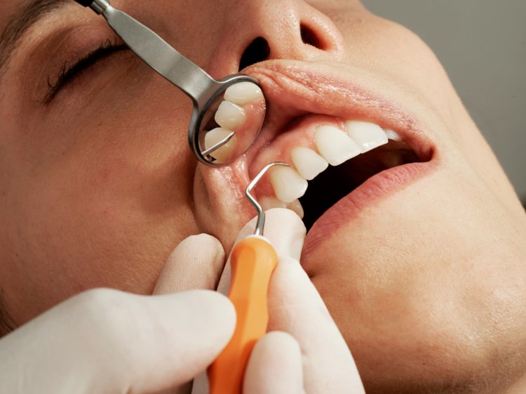 Stomatologie non-stop: când timpul devine un factor critic în sănătatea dentară